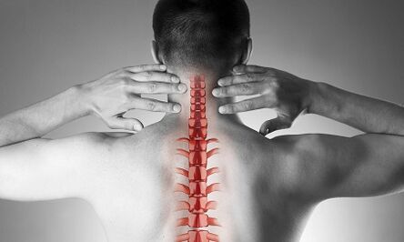 How manifested osteochondrosis of the cervical spine