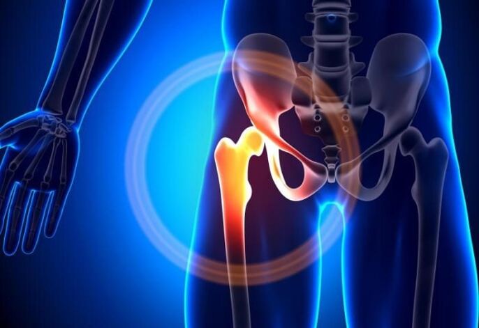 thigh pain